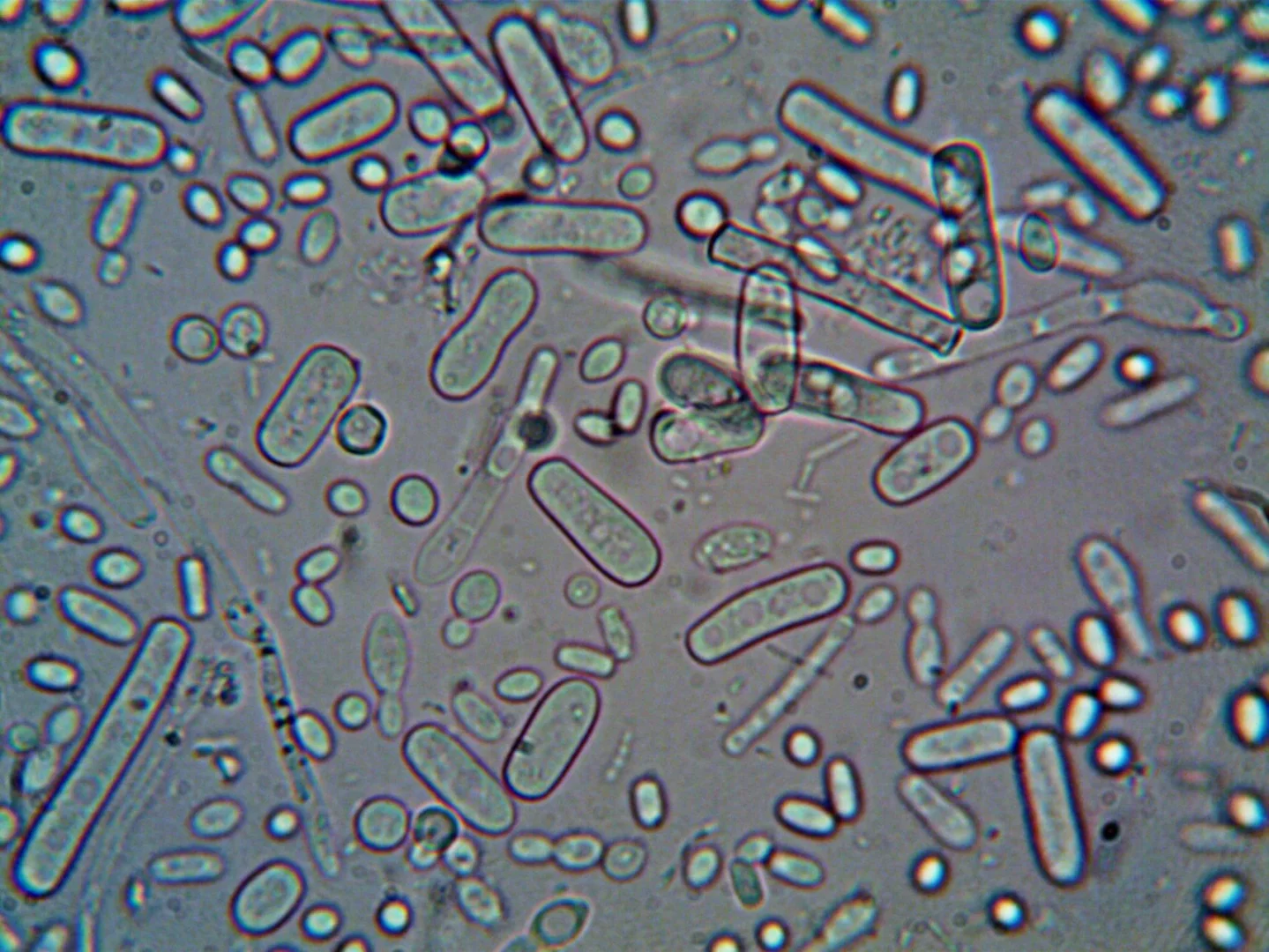 Как Pseudomonas aeruginosa чувствует железо снаружи и внутри клетки